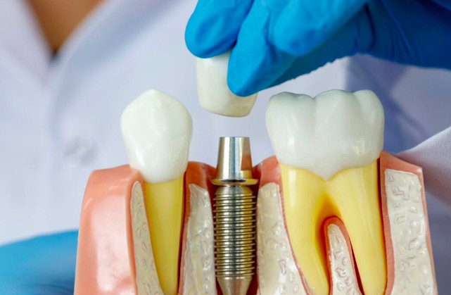  Качественное недорогое протезирование зубов 1666854473904